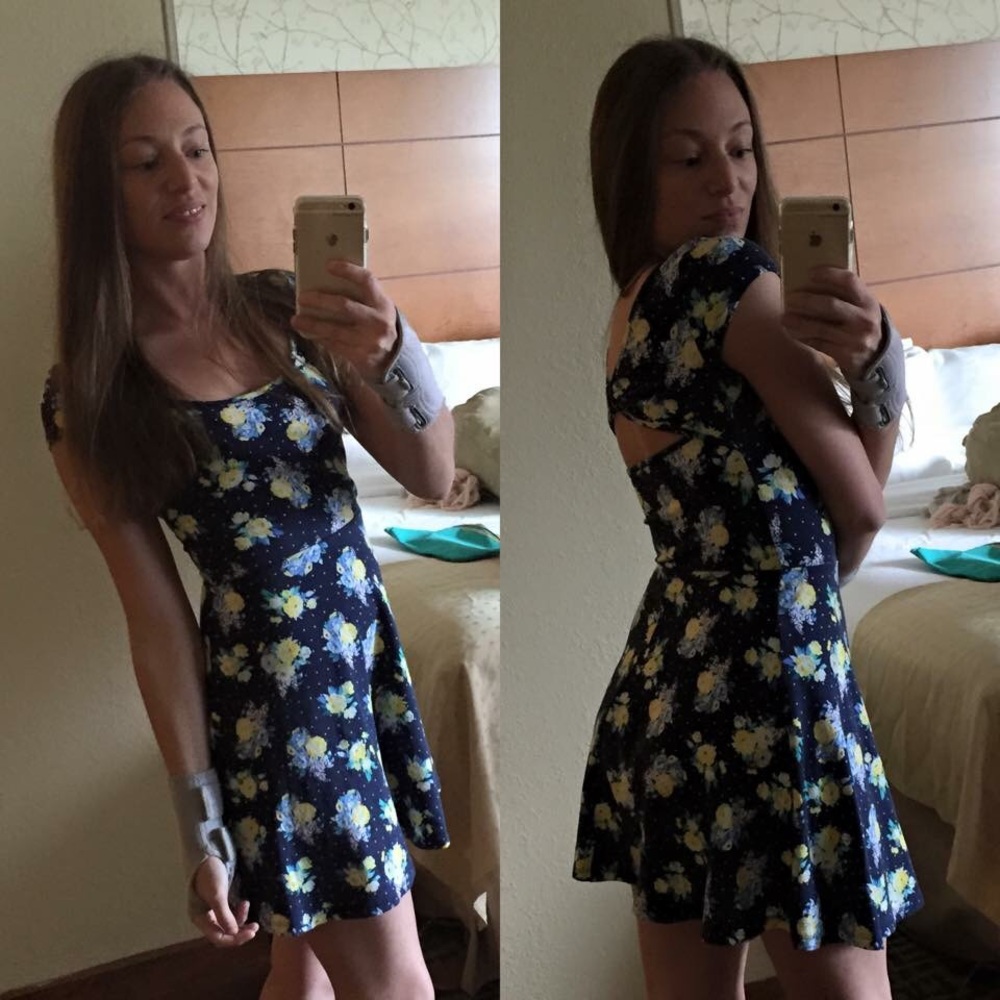 Charlotte Russe | Blue Floral Skater Dress